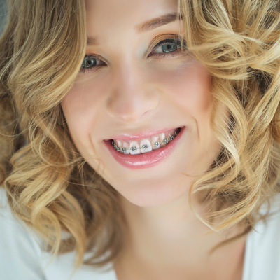 The image is a portrait of a woman with braces, smiling at the camera.