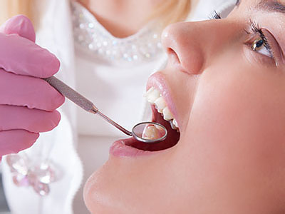 The image shows a dental professional performing a dental procedure on a patient, with the patient s mouth open and the dentist using a tool to work on the teeth.